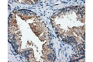 Immunohistochemical staining of paraffin-embedded Kidney tissue using anti-ELAVL1mouse monoclonal antibody. (ELAVL1 抗体)