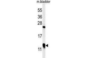 Western Blotting (WB) image for anti-Cysteine-Rich Protein 1 (Intestinal) (CRIP1) antibody (ABIN3002116) (CRIP1 抗体)