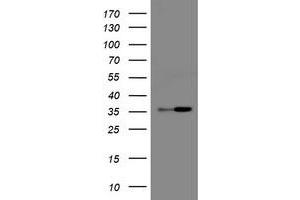 Image no. 1 for anti-Replication Factor C (Activator 1) 2, 40kDa (RFC2) antibody (ABIN1500671) (RFC2 抗体)