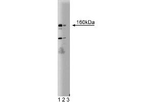 Western blot analysis of DAP Kinase on a SKN (human neuroblastoma) lysate. (DAP Kinase 1 抗体  (AA 694-947))