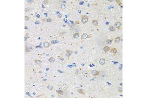 Immunohistochemistry of paraffin-embedded rat brain using GNE antibody. (GNE 抗体  (AA 1-150))
