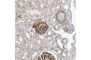 Immunohistochemical staining of human kidney with TRIM66 polyclonal antibody  shows strong cytoplasmic positivity in glomerular cells. (TRIM66 抗体)