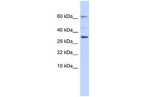 WB Suggested Anti-KCNIP2 Antibody Titration:  0. (KCNIP2 抗体  (N-Term))