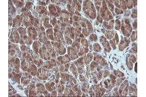 Image no. 1 for anti-Mitogen-Activated Protein Kinase Kinase 3 (MAP2K3) antibody (ABIN1499400) (MAP2K3 抗体)