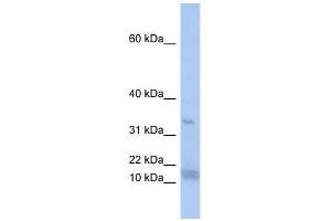SF3B14 antibody used at 1 ug/ml to detect target protein. (Pre-mRNA Branch Site Protein p14 (SF3B14) (N-Term) 抗体)