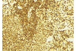 ABIN6269394 at 1/100 staining Mouse spleen tissue by IHC-P.