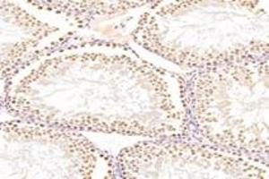 Immunohistochemistry analysis of paraffin-embedded mouse testis using,RanBP16 (ABIN7073901) at dilution of 1: 2000