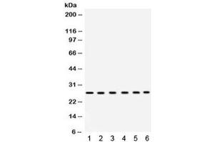 Western blot testing of 1) rat heart, 2) rat liver, 3) mouse liver, 4) human placenta, 5) COLO320 and 6) HeLa lysate with EIF3A antibody. (EIF6 抗体  (AA 66-210))