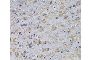 Immunohistochemistry of paraffin-embedded Rat brain using GAD2 Polyclonal Antibody at dilution of 1:100 (40x lens). (GAD65 抗体)