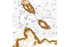 Immunohistochemistry analysis of paraffin embedded mouse skin using CK6 (ABIN7074423) at dilution of 1: 1000 (Keratin 6 抗体)