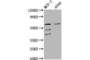 Western Blot Positive WB detected in: MCF-7 whole cell lysate, A549 whole cell lysate All lanes: SLC22A5 antibody at 4. (SLC22A5 抗体  (AA 42-142))
