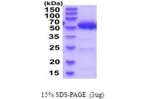 SDS-PAGE (SDS) image for Aldehyde Dehydrogenase 2 Family (Mitochondrial) (ALDH2) (AA 20-519) protein (His tag) (ABIN5854256) (ALDH2 Protein (AA 20-519) (His tag))