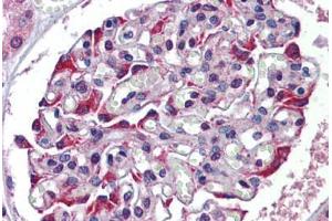 Human Kidney: Formalin-Fixed, Paraffin-Embedded (FFPE) (TDO2 抗体  (N-Term))