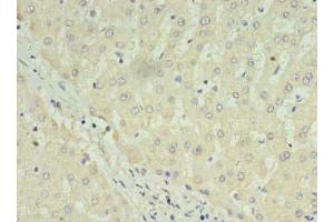 Immunohistochemistry of paraffin-embedded human liver tissue using ABIN7175057 at dilution of 1:100 (C1ORF123 抗体  (AA 1-160))