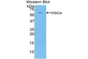 Detection of Recombinant MAP2, Rat using Polyclonal Antibody to Microtubule Associated Protein 2 (MAP2) (MAP2 抗体  (AA 1459-1718))