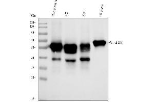 Western blot analysis of AHSG using anti-AHSG antibody (ABIN3043534).
