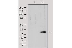 Western blot analysis of extracts from mouse heart, using TNFRSF6B Antibody.