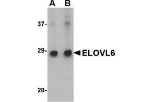 Western Blotting (WB) image for anti-ELOVL Fatty Acid Elongase 6 (ELOVL6) (N-Term) antibody (ABIN1031365) (ELOVL6 抗体  (N-Term))