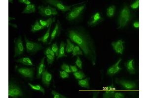 Image no. 2 for anti-serum/glucocorticoid Regulated Kinase 1 (SGK1) (AA 1-432) antibody (ABIN598922) (SGK1 抗体  (AA 1-432))