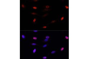 Immunofluorescence analysis of U-2 OS cells using SUMO3 antibody (ABIN7270371) at dilution of 1:100. (SUMO3 抗体  (AA 1-92))