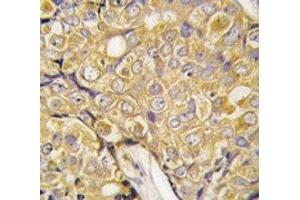 Immunohistochemistry (IHC) image for anti-Transient Receptor Potential Cation Channel, Subfamily M, Member 8 (TRPM8) (AA 521-552) antibody (ABIN3029240)