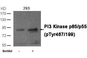 Western blot analysis of extracts from 293 cells untreated or treated with sorbitol using PI3 Kinase p85/p55 (phospho-Tyr467/199)Antibody. (PIK3R1/PIK3R3 抗体  (pTyr467))
