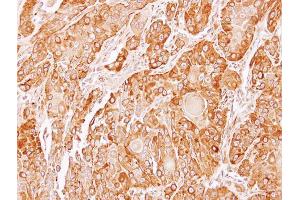 IHC-P Image Immunohistochemical analysis of paraffin-embedded SCC4 xenograft, using TXNDC4, antibody at 1:100 dilution. (ERP44 抗体)
