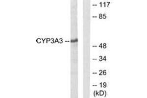 Western Blotting (WB) image for anti-Cytochrome P450, Family 3, Subfamily A, Polypeptide 4/5 (CYP3A4) (AA 251-300) antibody (ABIN2889952) (CYP3A4 抗体  (AA 251-300))