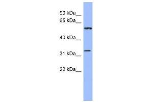 DDC antibody used at 1 ug/ml to detect target protein. (DDC 抗体)