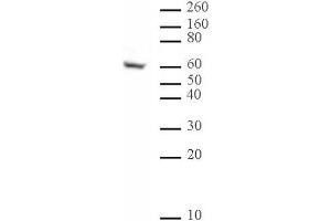 Ikaros antibody (mAb) (Clone 2A9) tested by Western blot. (IKZF1 抗体  (N-Term))