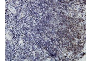 Immunoperoxidase of monoclonal antibody to EPHB3 on formalin-fixed paraffin-embedded human lymph node. (EPH Receptor B3 抗体  (AA 899-997))