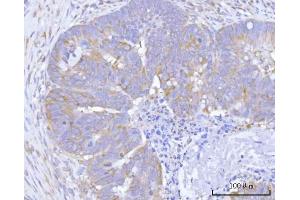 IHC analysis of Hamartin/TSC1 using anti-Hamartin/TSC1 antibody (ABIN7599499). (TSC1 抗体  (AA 1-618))
