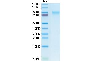 Human GUCY2C on Tris-Bis PAGE under reduced condition.