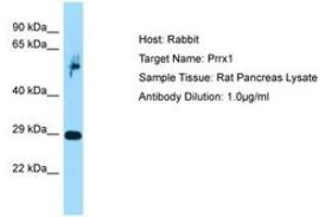 Image no. 1 for anti-Paired Related Homeobox 1 (PRRX1) (C-Term) antibody (ABIN6749858) (PRRX1 抗体  (C-Term))