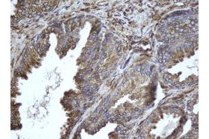 Image no. 2 for anti-Epoxide Hydrolase 1, Microsomal (Xenobiotic) (EPHX1) (AA 21-230) antibody (ABIN1491197) (EPHX1 抗体  (AA 21-230))