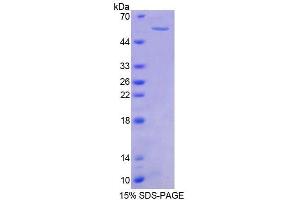 SDS-PAGE analysis of Mouse PTK2b Protein. (PTK2B 蛋白)