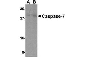 Western blot analysis of Caspase-7 in mouse skeletal muscle cell lysate with Caspase-7 antibody at (A) 0. (Caspase 7 抗体  (N-Term))