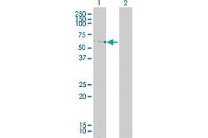 Western Blot analysis of LSM16 expression in transfected 293T cell line by LSM16 monoclonal antibody (M01A), clone 4E3-3A4. (EDC3 抗体  (AA 1-508))
