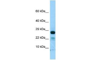 WB Suggested Anti-IL22RA2 Antibody Titration: 1. (IL22RA2 抗体  (C-Term))