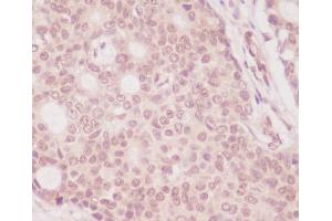 Immunohistochemistry (Paraffin-embedded Sections) (IHC (p)) image for anti-Eukaryotic Translation Initiation Factor 4E Binding Protein 1 (EIF4EBP1) antibody (ABIN7606936)