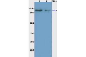 Lane 1: rat brain lysates Lane 2: rat kidney lysates probed with Anti ATG9A Polyclonal Antibody, Unconjugated (ABIN752488) at 1:200 in 4 °C. (ATG9A 抗体  (AA 301-400))