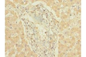 Immunohistochemistry of paraffin-embedded human liver tissue using ABIN7149266 at dilution of 1:100