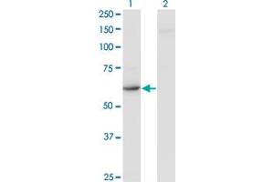 Western Blot analysis of CDR2 expression in transfected 293T cell line by CDR2 monoclonal antibody (M03), clone 4D2. (CDR2 抗体  (AA 1-454))