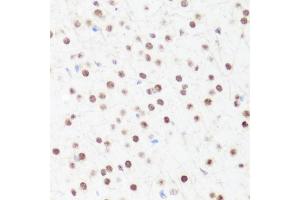 Immunohistochemistry of paraffin-embedded mouse brain using MonoMethyl-Histone H4-R3 antibody (ABIN1680263, ABIN1680264, ABIN6220110 and ABIN6220114) at dilution of 1:100 (40x lens). (Histone H4 抗体  (meArg3))