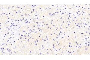 Detection of IkBa in Human Cardiac Muscle Tissue using Polyclonal Antibody to Inhibitory Subunit Of NF Kappa B Alpha (IkBa) (Inhibitory Subunit Of NF kappa B alpha (AA 74-247) 抗体)