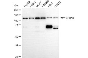 Western blotting analysis using EPHA6 antibody (ABIN7798454).
