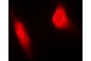 Immunofluorescent analysis of MGCRACGAP staining in HeLa cells. (RACGAP1 抗体)