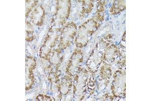 Immunohistochemistry (IHC) image for anti-Methylenetetrahydrofolate Dehydrogenase (NADP+ Dependent) 2, Methenyltetrahydrofolate Cyclohydrolase (MTHFD2) (AA 40-250) antibody (ABIN6144144)