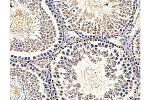 ABIN7096438 and ABIN7100502 at 1/100 staining rat testis tissue by IHC-P. (GRAMD1B 抗体)
