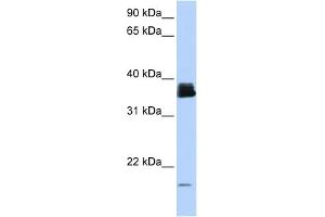 WB Suggested Anti-PPIA Antibody Titration:  0. (PPIA 抗体  (N-Term))